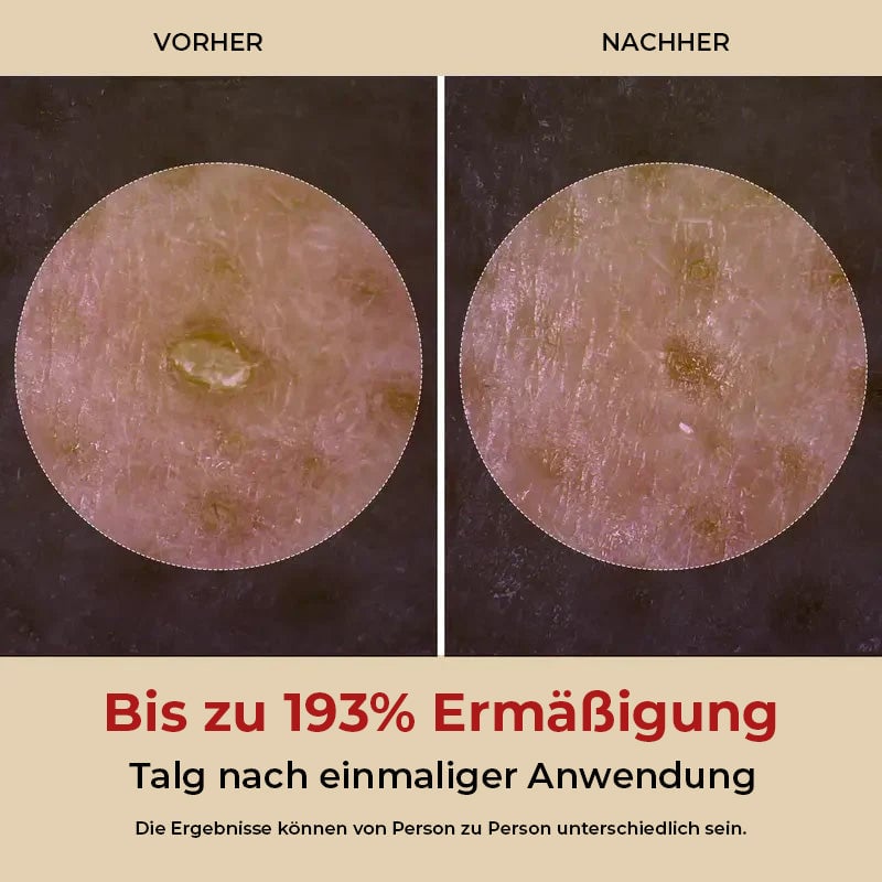 Sanftes Peeling-Ampulle – Schwarzer Reis