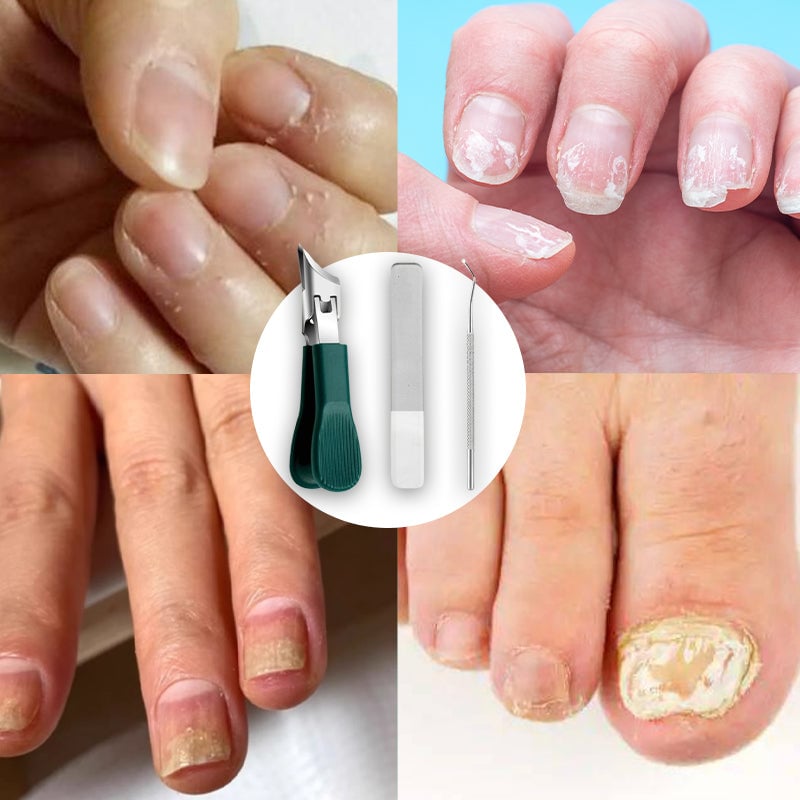 Premium 3-teiliges Adlerschnabel-Nagelknipser-Set