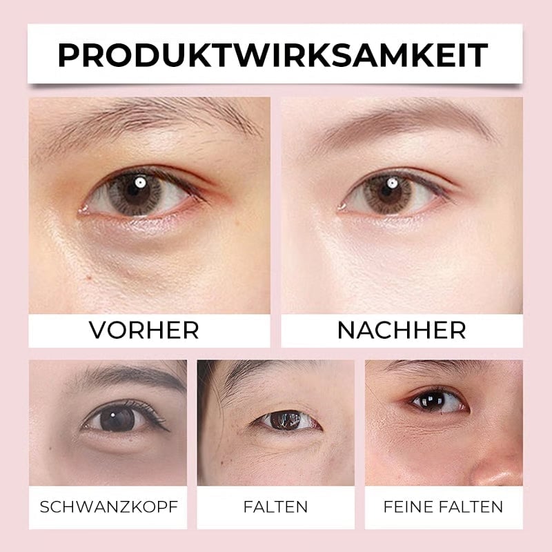 Elektrische Massage-Augencreme gegen Augenringe